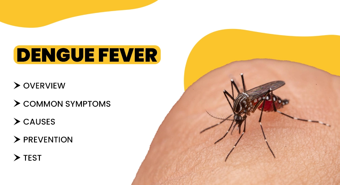 dengue fever, symptoms, causes and its treatments