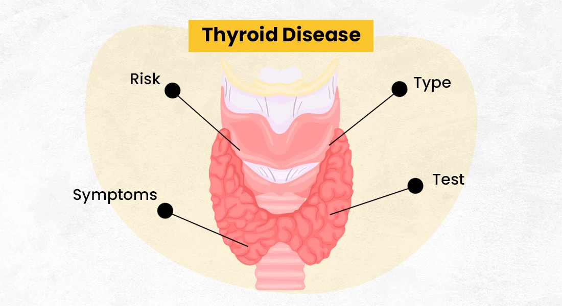 Thyroid disease - Type, Risk, Symptoms And Diagnostic Tests