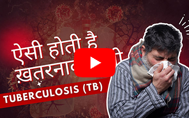 M.D. Microbiology, Tuberculosis, TB, Lung Disease