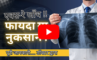 X-Ray Test,  X-Ray Beneficial, X-Ray In Hindi