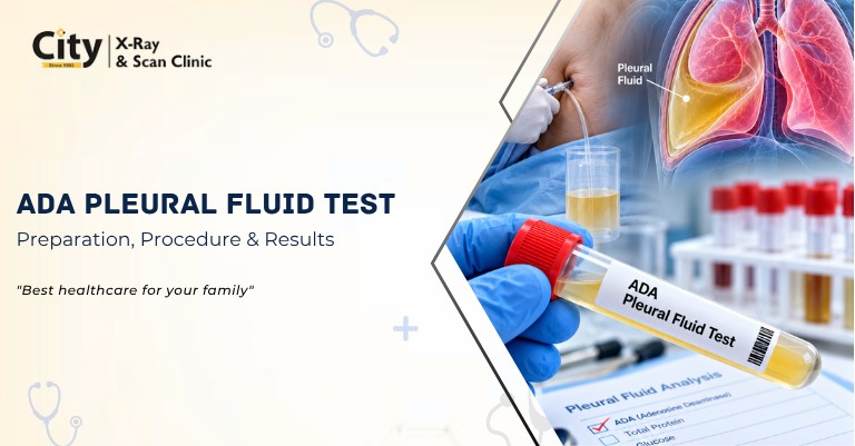 ADA Pleural Fluid Test: Price, Preparation, Procedure & Results