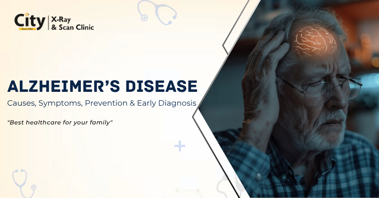 Alzheimers Disease Causes and symptoms and preventation