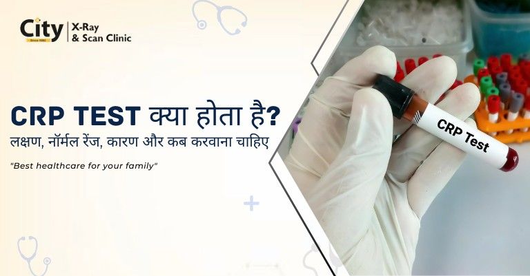 CRP Test in Hindi