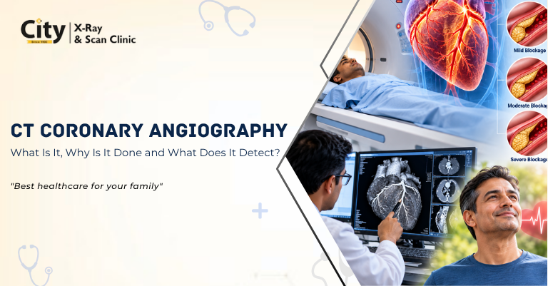 CT Coronary Angiography: What Is It, Why Is It Done and What Does It Detect?