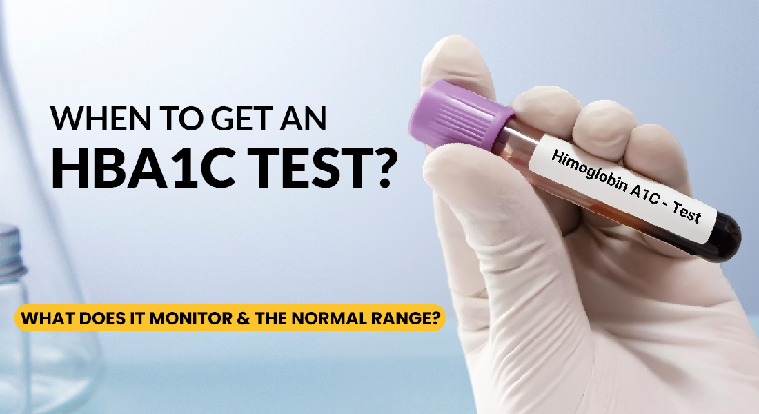 HbA1c Test - What is Purpose, How It Works, and Price