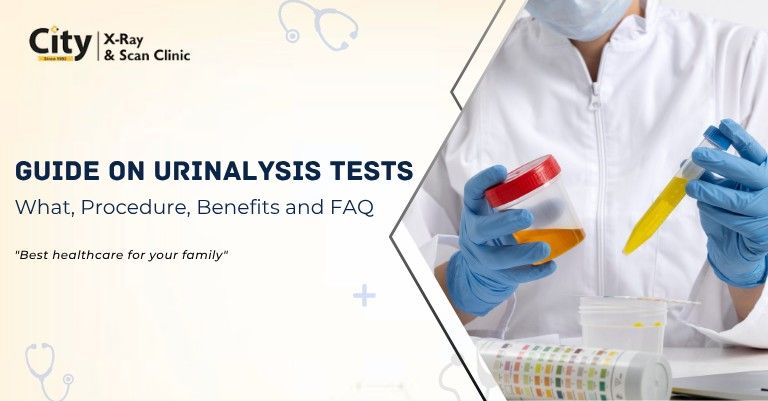 Complete Guide on Urinalysis Tests
