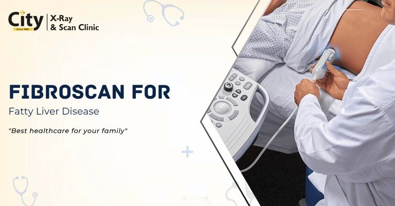 FibroScan for Fatty Liver Disease Evaluation and Grading