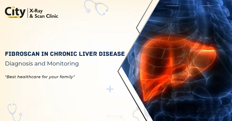 FibroScan in Chronic Liver Disease: Diagnosis and Monitoring