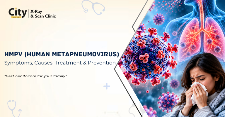 HMPV (Human Metapneumovirus): Symptoms, Causes, Transmission, Testing, Treatment & Prevention