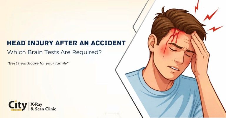 Head Injury After an Accident: Which Brain Tests Are Required?