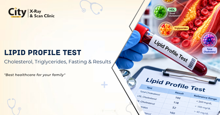 Lipid Profile Test: Cholesterol, Triglycerides, Fasting & Results