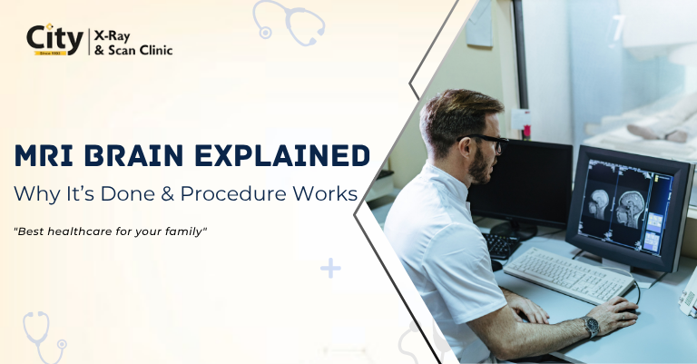 MRI brain scan procedure and purpose