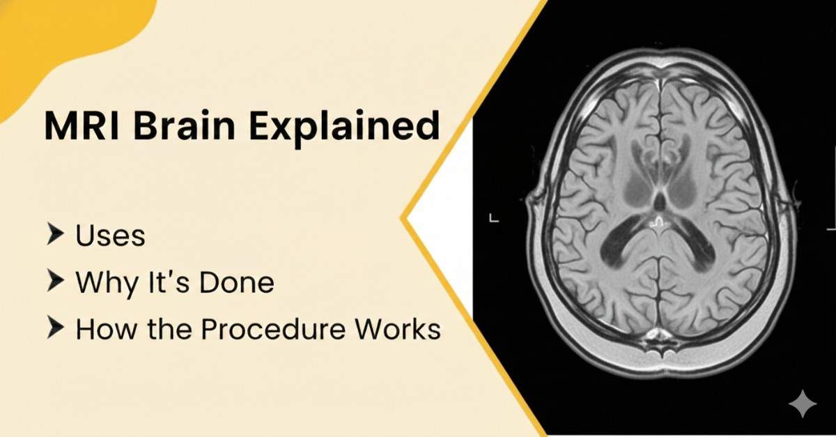 MRI Brain Explained: Why It’s Done and How the Procedure Works
