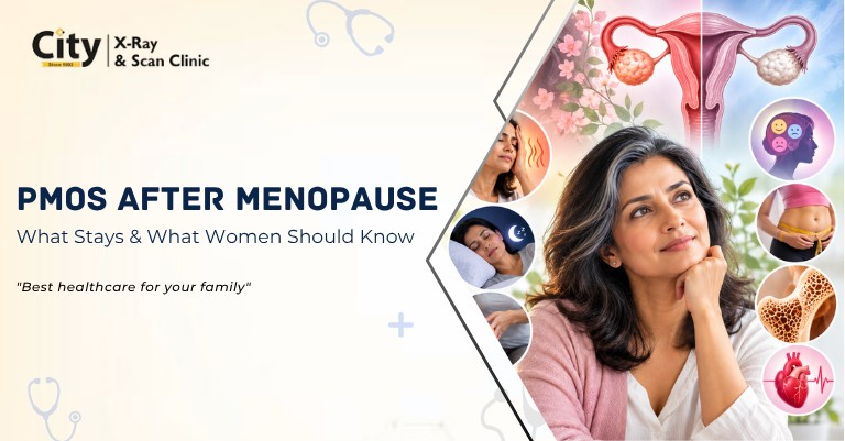 PMOS After Menopause: What Changes, What Stays, and What Women Should Know