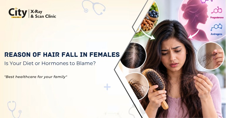 Reason of Hair Fall in Females: Is Your Diet or Hormones to Blame?