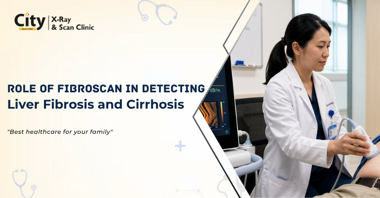 Role of FibroScan in Detecting Liver Fibrosis and Cirrhosis