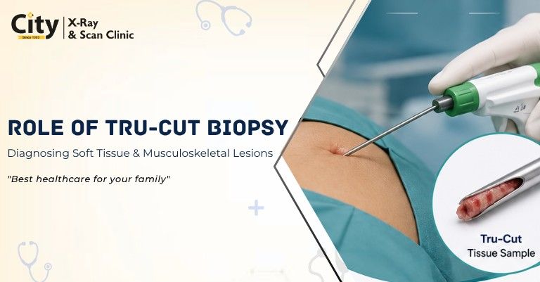 Role of Tru-Cut Biopsy in Diagnosing Soft Tissue and Musculoskeletal Lesions