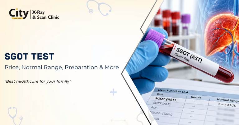 SGOT Test: Price, Normal Range, Preparation & More