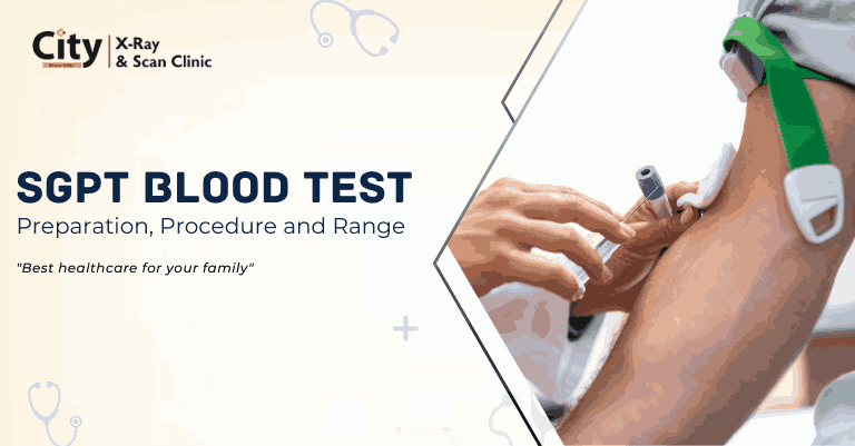 SGPT Blood Test