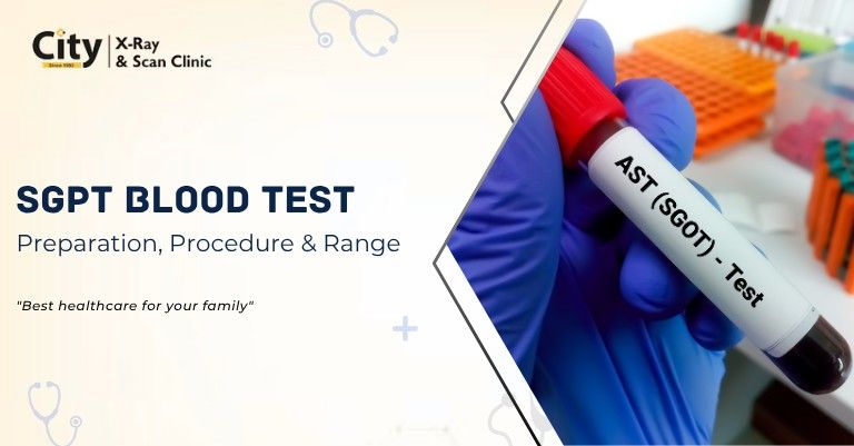 SGPT Blood Test Preparation, Procedure and Normal Range