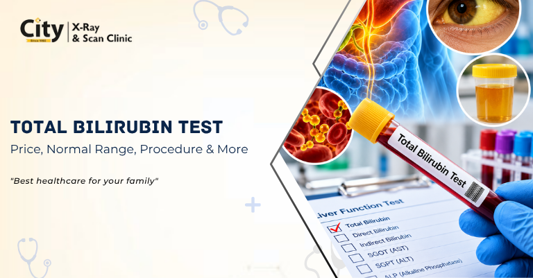 Total Bilirubin Test: Price, Normal Range, Procedure & More