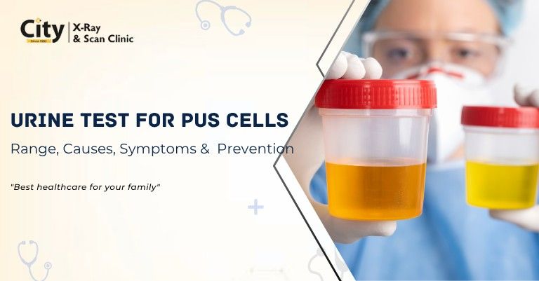 Urine Examination Pus Cells