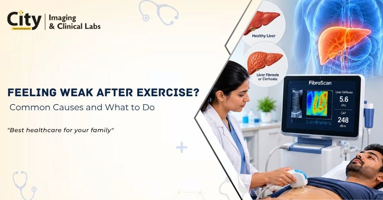 What to Expect During a FibroScan: Procedure, Preparation, Duration and Results