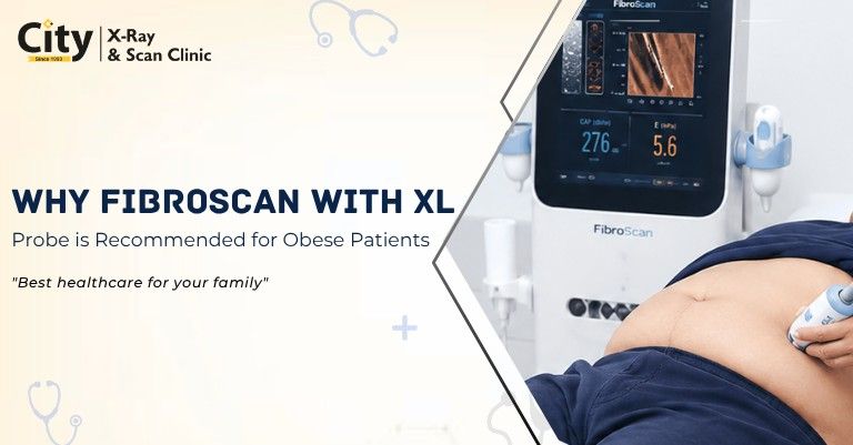 Why FibroScan with XL Probe is Recommended for Obese Patients