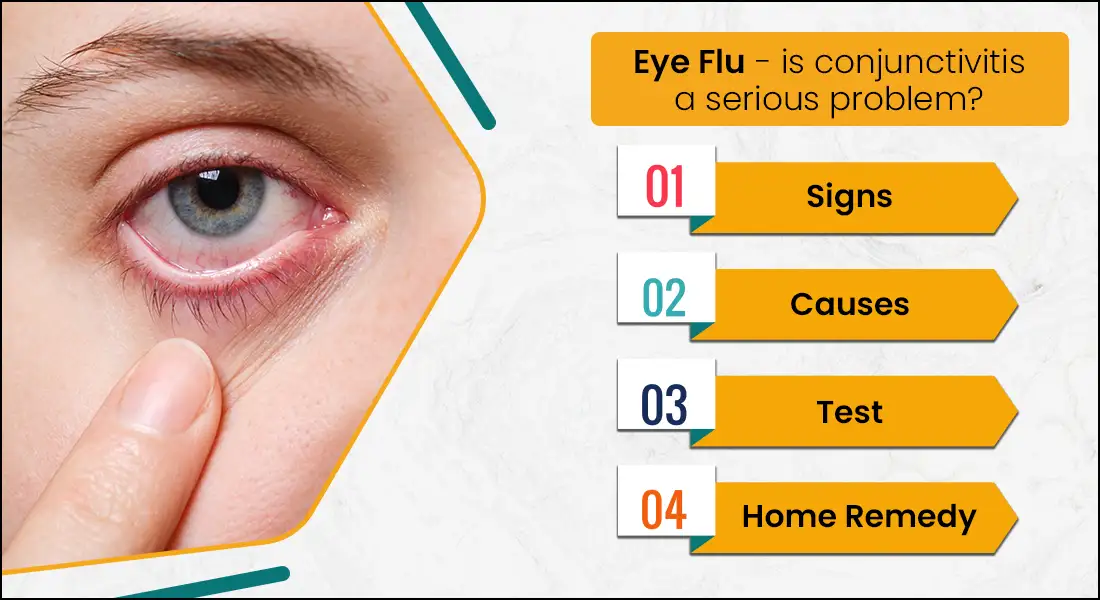 What Is Viral Conjunctivitis - Eye Flu? Symptoms Causes And Tests