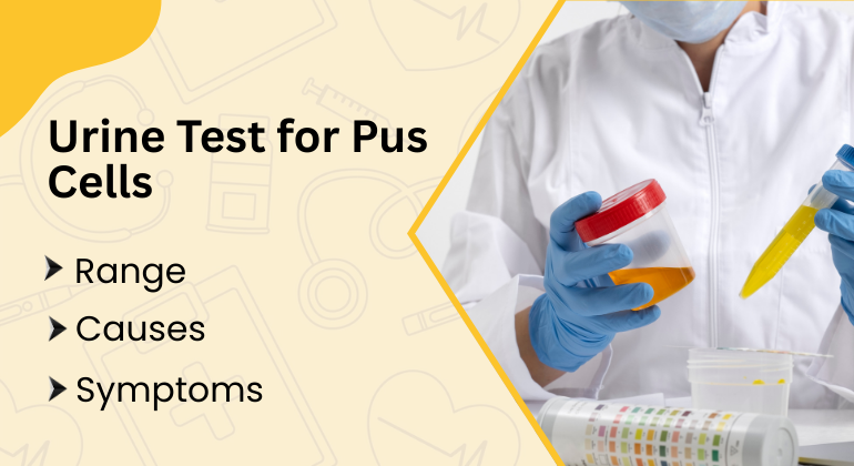 Urine Test for Pus Cells: Normal Range, Causes, Symptoms and Prevention